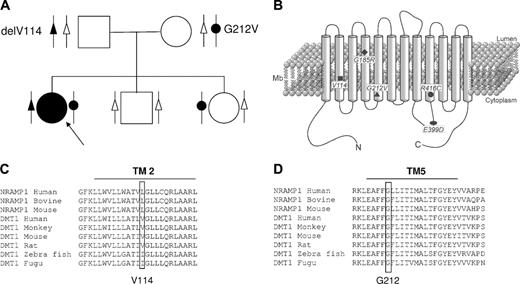 Figure 1. Family tree of the patient with new DMT1 mutations, position and conservation of these and previous mutations. (A) Pedigree of the family with 2 new DMT1 mutations. The black symbols denote a mutated allele, and the white symbol a normal allele. Arrow indicates the proband. (B) Schematic representation of the DMT1 molecule and position of the amino acid changes described in the mk mice (G185R) and in human patients. delV114 and G212V are reported here. R416C is a heterozygous mutation associated with c310-3_5delCTT described by Ioalescon et al.14 E399D is a homozygous mutation described by Mims et al.10 Multiple sequence alignments of DMT1 orthologs are shown for residues forming the second predicted transmembrane domain (C) and the fifth transmembrane domain (D).