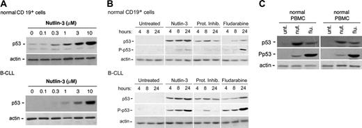 Figure 2. p53 induction and Ser15 phosphorylation in B-CLL and in normal cells upon treatment with nutlin-3. Induction of p53 and levels of Ser15 phosphorylated-p53 (P-p53) were assessed by Western analysis. (A) Dose-dependent induction of p53 in normal CD19+ B and B-CLL cells after 24 hours of incubation with increasing doses of nutlin-3. Representative examples of 4 independent experiments are shown. (B) Normal CD19+ B and B-CLL cells were either left untreated or incubated with nutlin-3 (10 μM), or the proteasome inhibitor (Prot Inhib) clasto-lactacystin (25 μM), or fludarabine (10 μM) for the indicated time. Representative examples of 3 independent experiments are shown. (C) Normal PBMCs and BMMCs were either left untreated or incubated with nutlin-3 (10 μM) or fludarabine (10 μM) for 24 hours. Representative examples of 3 BMMC or 5 PBMC independent experiments are shown.