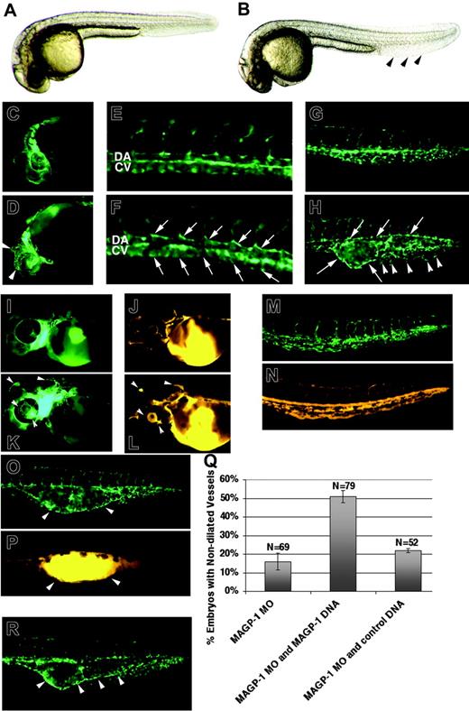 Figure 1. Underexpression and overexpression of magp1 result in vascular defects in zebrafish embryos. Bright-field images of an uninjected Tg(fli1/EGFP) embryo (A) and an magp1 MO–injected embryo (B) at 30 hours after fertilization. magp1 MO–injected embryos display normal morphology, except for the expanded tail fin (arrowheads). Compared with the uninjected Tg(fli1/EGFP) embryo (C, E, G), magp1 MO–injected Tg(fli1/EGFP) embryos exhibit distended vessels in the brain and the eye (D, arrowheads; 47% ± 16%; N = 60), axial vessels with irregular lumens (F, arrows; 70% ± 3%; N = 36), and dilated vascular channel in the venous plexus (H, arrows) with only a few branches of venous microvessels (H, arrowheads; 96% ±;N = 84). DA indicates dorsal aorta; CV, cardinal vein. To assess functionality of the circulation, microangiography was conducted on Tg(fli1/EGFP) embryos (I, M, uninjected embryos; K, O, magp1 MO–injected embryos) at 48 hours after fertilization using TRITC dextran. Compared with uninjected Tg(fli-1/EGFP) embryos (J, N), magp1 MO–injected Tg(fli1/EGFP) embryos (L, P) display lumenized vasculature. However, pooling of TRITC dextran in dilated regions of the blood vessels is observed in magp1 MO–injected Tg(fli1/EGFP) embryos (L, P, arrowheads). The corresponding region of dilated vessels for panel P is shown in panel O as indicated by arrowheads. (Q) Summary of 3 independent experiments showing alleviation of 3 ng magp1 MO–induced vascular defects with the introduction of Magp1 protein through injection of 10 pg magp1 expression construct (compare columns 2 and 1; P = .01). N indicates the number of embryos scored. In contrast, coinjection of 10 pg control expression construct, FRM-DsRED, does not affect the frequency of the magp1 MO–induced vascular defects (column 3). Error bars indicate SEM. (R) Overexpression of magp1 generates a range of vascular defects, including the dilation of caudal vein (arrowheads). Original magnifications: (A-D, G-H, I-P, R) 5 ×; (E-F) 10 ×.