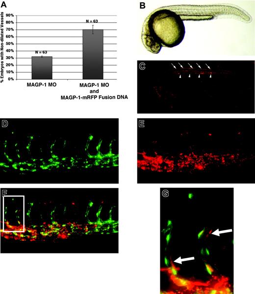 Figure 5. Distribution of functional Magp1-mRFP protein during early development. DNA encoding the Magp1-mRFP fusion construct was injected into wild-type embryos, yielding a mosaic distribution of the fusion protein as observed at 12 hours after fertilization (data not shown). By 24 hours, the Magp1-mRFP fusion protein exhibited localized tissue distribution. (A) Coinjection of the Magp1-mRFP fusion construct alleviated the vascular defects in magp1 morphant embryos (compare columns 2 and 1). Error bars indicate SEM. (B) Bright-field image of a wild-type embryo at 24 hours after fertilization. (C) Wild-type embryo injected with 12 pg Magp1-mRFP fusion construct under rhodamine illumination, showing enrichment of the Magp1 protein around the notochord (arrowheads) and in the dorsal connective tissues (arrows). (D) Tg(fli1/EGFP) embryo injected with 12 pg Magp1-mRFP fusion construct, showing the endothelium-lined vasculature under FITC illumination. (E) Distribution of Magp1-mRFP fusion protein is visualized under the rhodamine filter. (F) Overlay of panels D and E, showing the enrichment of the Magp1-mRFP fusion protein around the developing vasculature. (G) Inset from panel F, as indicated by the rectangle in panel F, showing the Magp1-mRFP fusion protein to be in close association with the endothelial cells (arrows). Anterior is to the left for all panels. (B-G) Original magnifications, 5 ×.