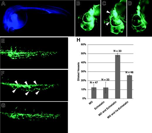 Figure 6. Magp1 and integrin functionally interact in vivo during vascular development. A mixture of the disintegrin Echistatin and blue dextran was injected into the common cardinal veins of wild-type and magp1 MO–injected Tg(fli1/EGFP) embryos at 24 to 25 hours after fertilization by microangiography. Embryos successfully injected, as indicated by the blue fluorescence in the circulation (A), were selected for phenotypic analysis at 30 hours after fertilization. The head (B) and the tail (E) of a Tg(fli1/EGFP) embryo at 30 hours after fertilization. The head (C) and the tail (F) of a Tg(fli1/EGFP) embryo injected with 1 ng magp1 MO and Echistatin showing dilation of vessels in the midbrain–hindbrain region, around the eye (C, arrowheads) and the caudal vein (F, arrowheads). The head (D) and the tail (G) of a Tg(fli1/EGFP) embryo injected with 1 ng magp1 MO and heat-attenuated Echistatin, exhibiting no significant change in the vasculature compared with wild-type embryos. (H) Summary of 2 independent injection experiments; 1 ng magp1 morpholino and 9 nL 20 μM Echistatin solution were injected (see “Injection of the integrin antagonist Echistatin”). HA indicates heat-attenuated; N, number of embryos scored. Error bars indicate SEM. (A-G) Original magnifications, 10 ×.