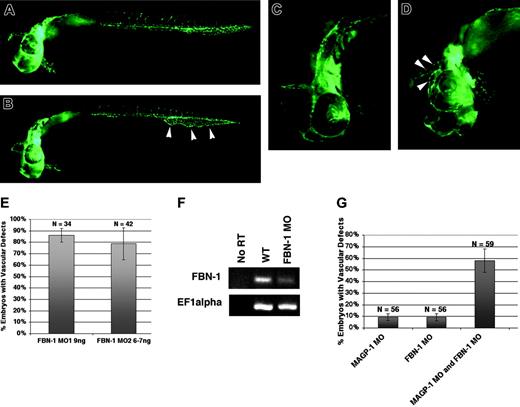 Figure 7. Phenotypic analysis of fibrillin-1 (fbn1) morphant embryos. (A) Uninjected Tg(fli1/EGFP) embryo at 31 hours after fertilization. (B) fbn1 MO–injected Tg(fli1/EGFP) embryo at 31 hours after fertilization, showing dilated caudal vein with reduced venous plexus formation (arrowheads). Frequency, 86% ± 4%; N = 45. (C) Anterior segment of an uninjected Tg(fli1/EGFP) embryo at 31 hours after fertilization. (D) fbn1 MO–injected Tg(fli1/EGFP) embryo at 31 hours after fertilization showing dilated vessels around the eye and in the head (arrowheads). (E) Two splice-site morpholinos against the fbn1 gene generate similar vascular defects at high frequency. (F) RT-PCR analysis demonstrating depletion of the endogenous fbn1 transcript in fbn1 MO–injected embryos. (G) Summary of 2 independent injection experiments. Synergy between magp1 MO and fbn1 MO in generating embryos with dilated vessels (compare column 3 with columns 1 and 2). In these experiments, 1 ng magp1 MO and 2 ng fbn1 MO were used. N indicates number of embryos scored. Original magnifications: (A-B) 5 ×; (C-D) 10 ×. (E,G) Error bars indicate SEM.