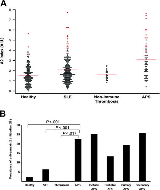 Figure 1. Prevalence of anti–A2 IgG and IgM in patients with antiphospholipid syndrome. (A) A2 Index. Sera from healthy controls (Healthy), patients with lupus without thrombosis (SLE), patients with thrombosis related to nonimmune risk factors (Nonimmune Thrombosis), and patients with antiphospholipid syndrome (APS) were analyzed for anti-A2 antibodies by ELISA as described in “Patients, materials, and methods.” For each patient, the A405 value for either IgG or IgM was expressed as a ratio to the mean A405 value for 30 simultaneously evaluated healthy control samples. The sum of the IgG and IgM ratios (A2 index) for each individual patient is represented as a single point. Shown in red are the A2 index values for patients with either IgG or IgM titers that exceed the mean control value by more than 3 SDs. Bars indicate mean values for each group. (B) Prevalence of anti-A2 antibodies (3 SDs) in patient subgroups. For each group, the percentage of patients with an anti–A2 IgG or IgM titer that exceeds the mean control value by more than 3 SDs is shown. Absolute optical density values are 1.16 for IgG and 0.15 for IgM. P values for anti-A2 antibodies in antiphospholipid syndrome (APS), compared with healthy controls (Healthy), patients with systemic lupus erythematosus without thrombosis (SLE), or individuals with nonimmune thrombosis (Thrombosis) were highly significant (P < .001, P < .001, and P < .017, respectively). Antibody prevalence is also shown for APS subgroups as defined by Sapporo Criteria.1