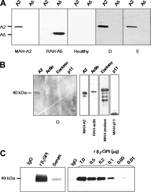 Figure 2. Characterization of anti–A2 IgG. (A) Specificity of anti–A2 IgG detected by ELISA. Lanes were loaded with either recombinant A2 (A2, 1 μg) or recombinant annexin 5 (A5, 1 μg), and IgG reactivity was analyzed by immunoblot. Positive controls were mouse monoclonal anti–human A2 IgG (MAH-A2) and rabbit polyclonal anti–human A5 (RAH-A5), respectively. Reactivity of IgG from an individual lacking anti-A2 antibodies (Healthy), and from 2 of 9 patients (D-E) positive for anti–A2 IgG is shown. Blots were developed as described in “Patients, materials, and methods” with secondary HRP-conjugated IgG. Shown are images grouped from different gels. (B) Assay of reactivity of anti-A2–containing IgG samples to other proposed plasminogen-binding proteins. SDS polyacrylamide gels were loaded with A2, actin, enolase, or p11 (1 μg/lane). Shown is reactivity of a representative patient anti-A2–containing IgG sample (patient D). Specific antibodies against the purified proteins of interest (mouse anti–human A2, rabbit anti–human actin, rabbit anti–human enolase, or mouse anti–human p11) served as positive controls (right panels). (C) Role of β2GPI. Assay of patient IgG for the presence of β2GPI (left panel). SDS polyacrylamide gels (10%) were loaded with patient purified recombinant IgG, β2GPI, or patient serum (1 μg/lane), transferred to nitrocellulose membranes, and reacted with goat anti–human β2GPI antibodies. Results indicate no detectable β2GPI in the lane containing purified IgG. Determination of assay sensitivity for β2GPI (right panel). Patient IgG (1 μg) and progressive dilutions of β2GPI (10 to 1000 ng/lane) were loaded in the same manner onto 10% SDS gels, blotted to nitrocellulose membranes, and probed with goat anti–human β2GPI antibodies. The assay was sensitive to 50 ng per lane of β2GPI. All membranes were incubated with secondary HRP-conjugated anti–goat IgG antibodies and developed.