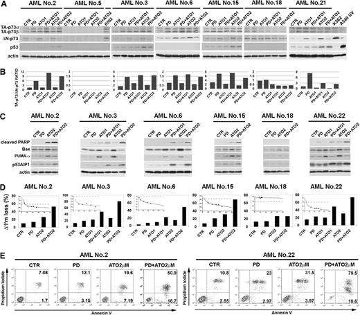 Figure 1. MEK-1 inhibition sensitizes AML blasts to ATO-induced apoptosis. (A) Primary AML blasts were seeded at 2.5 × 105 in the presence of DMSO (vehicle) or PD184352 (1 μM) for 3 hours and then were incubated for 18 hours with the indicated concentration of ATO. Endogenous TA-p73α, TA-p73β, and ΔN-p73 proteins were revealed by immunoblotting analysis using a mouse monoclonal anti-p73 (clone 1288) or a mouse monoclonal anti-ΔNp73 (clone 38C674) antibody. Endogenous p53 was revealed by immunoblotting using a mouse monoclonal anti-p53 (DO-1) antibody. Anti–actin immunoblotting was performed as loading control. (B) TA-p73α, TA-p73β, ΔN-p73, and β-actin bands were subjected to densitometric scanning using the TINA 2 software, and the TA-(p73α+p73β)/ΔN-p73 ratio was calculated. (C) Expression of PARP cleavage, Bax, PUMA, and p53AIP1 was revealed after 48 hours of treatment. Cell lysates were analyzed by immunoblotting analysis using mouse monoclonal anti-PARP (F2), rabbit polyclonal anti-Bax, rabbit polyclonal anti-PUMA, rabbit polyclonal anti-p53AIP1 (CT), and goat polyclonal anti–human actin. Antiactin immunoblotting was performed as loading control. (D) Primary AML blasts were cultured as described. After 48 hours of treatment, the cells were harvested for ΔΨm detection by flow cytometry. Values are expressed as percentage of cells with low ΔΨm. (inset) CI plot for the combination of escalating doses of PD184352 and ATO at a 1:1 ratio, obtained as described in the Table 1 footnote. The dashed line indicates a CI value of 1. CI, 1. (E) Primary AML blasts were cultured as described and were stained for annexin V binding. CTR indicates control; PD, PD184352 (1 μM).