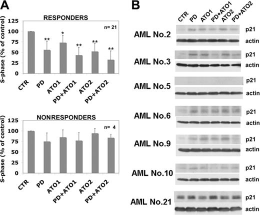 Figure 3. MEK blockade causes growth inhibition of leukemic cells and modulates p21Waf1/CIP1 expression in AML blasts. (A) Leukemic blasts from patients were cultured in the presence of PD 184352, ATO, or both for 48 hours and were stained for DNA content (*P < .05; **P < .001 vs control vehicle; Dunnett test). Values are mean ± SD. (B) AML blasts were cultured for 48 hours in the presence of PD 184352, ATO, or both and were subjected to Western blot analysis with mouse monoclonal anti-p21Waf1/Cip1 (DCS60).