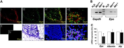 Figure 5. Epo expression analysis in wild-type and Wt1-deficient mouse embryos. (A) Double-immunofluorescence labeling for Wt1 (red) and EPO (green) in sections of the murine embryonic liver (E10.5). Wt1 is expressed predominantly in hepatocytes at the periphery of the liver because the typical lobular architecture at this early developmental stage is not yet established (Ai; higher magnification, Avii; negative control, Aii). Nuclear localization of Wt1 is confirmed by counterstaining with DAPI (Aviii,Aix). Hematoxylin-eosin staining reveals nests of hematopoietic progenitor cells in the developing liver (Av, arrow). Labeling of Epo is shown in Aiii, Avi, and Avii at higher magnification (Aiv, negative control). Note the colocalization of Wt1 and EPO in hepatocytes at the periphery of the liver (Avi, Avii, Aix). (B) Representative RT-PCR results for Epo mRNA expression in the liver of a mouse embryo at E12.0 with homozygous Wt1 deletion (Wt1-/-) in comparison with a wild-type littermate (Wt1+/+). Note the reduced Epo mRNA level in the liver of the Wt1-deficient embryo. Gapdh signal revealed a similar efficiency of RNA preparation and cDNA synthesis in both livers. For better visualization, the gel photograph is presented as a negative of the original. M = 100 bp DNA ladder as a marker for the size of PCR products. (C) Real-time RT-PCR analysis of Epo expression in the livers of 9 murine embryos (E12.0) lacking Wt1 (Wt1–/– ▪) compared with 9 wild-type littermates (Wt1+/+ □). EPO expression, which was defined as 100% in wild-type embryos, was normalized to β-actin transcripts. For comparison, albumin and α-fetoprotein (Afp) mRNA levels were not significantly different (P > .05) in the liver specimens of wild-type and Wt1-deficient embryos (n = 5 each). Values are mean ± SEM. *Statistical significance (P < .01; Student t test).