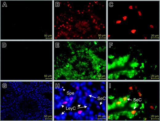 Figure 7. Colocalization of Wt1 and EPO in the adult murine testis. Double-immunofluorescence labeling for Wt1 (red) and EPO (green) in sections of the adult testis. (B-C) Staining of Wt1. (A) Negative control. Wt1 is present only in the nuclei of Sertoli cells. (E-F) Staining of EPO. (D) Negative control. EPO is detected in various cell types of the testis, but colocalization with Wt1 is restricted to Sertoli cells (yellow fluorescence, I). Counter-staining with DAPI is also shown in slides used for negative controls. SeC indicates Sertoli cell; LeyC, Leydig cell; SpeG, spermatogonia; SP, sperm.