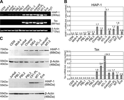 Figure 1. Overexpression of HIAP-1 in HTLV-1–infected human T-cells. HIAP-1 and Tax expressions were analyzed in HTLV-1–transformed T-cell lines (C91-PL and MT-2), ATL-derived cultures (Champ, StEd, ATL-3, and JuanaW), HAM/TSP-derived cultures (Eva), in uninfected ALL-derived CD4+ control T-cell lines (CCRF-CEM, Molt-4, and Jurkat), and in PBLs isolated from 3 healthy donors (PBL1-PBL3). (A) Total RNA was extracted and subjected to RT-PCR analyses. Equal loading was controlled by β-actin RT-PCR. (B) The same cDNAs were used for real-time RT-PCR analyses of HIAP-1, Tax, and β-actin (internal standard) transcripts. The relative mRNA copy numbers of HIAP-1 and Tax mRNA were determined as multiples of the β-actin mRNA copy number. The columns represent the mean of 6 experiments; the error bars, mean error. (C) To detect HIAP-1 protein, immunoblots were stained using HIAP-1–and β-actin–specific monoclonal antibodies.