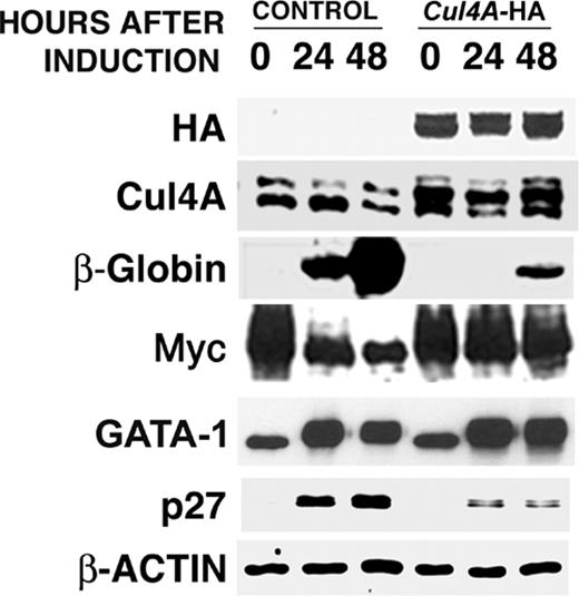 Figure 5. Cul4A-enforced expression attenuates differentiation into erythrocytes and reduces the accumulation of p27 protein. Cul4A-HA and empty vector control cells were induced to differentiate and aliquots of cells were taken 0, 24, and 48 hours after induction. Protein lysates were prepared, and 10 to 20 μg total protein for each sample was analyzed by immunoblot probed with antibodies that recognize HA, Cul4A, β-globin, c-Myc, GATA-1, p27, or actin. Actin was used as a loading control. Representative results of 3 independent experiments are shown.