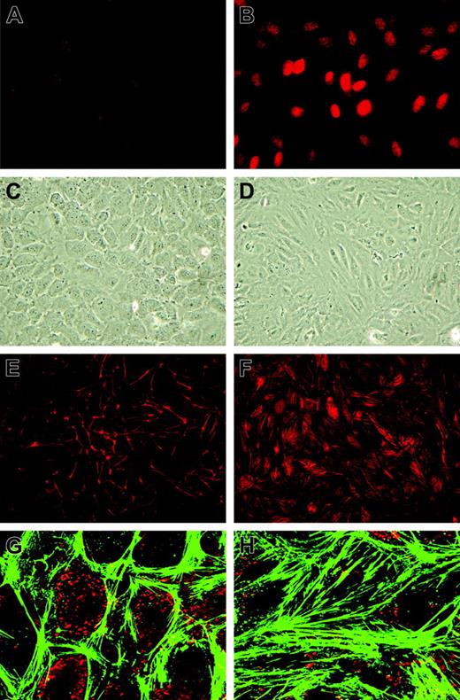 Figure 2. Morphologic changes of HUVECs induced by prolonged KLF2 overexpression. HUVECs were transduced with Lenti-mock (A,C,E,G) or Lenti-KLF2 (B,D,F,H) and analyzed 7 days after transduction. (A-B) Immunofluorescence using an anti–human KLF2 antibody. (C-D) Phase-contrast imaging. (E-F) Phalloidin-TRITC staining for F-actin stress fibers. (G-H) Close-ups of phalloidin-FITC staining (green) with VWF immunofluorescence (red) used for orientation. Images were acquired using a 20 × /0.5 NA objective (A-F) or a 63 × /1.4 NA oil objective (G-H).