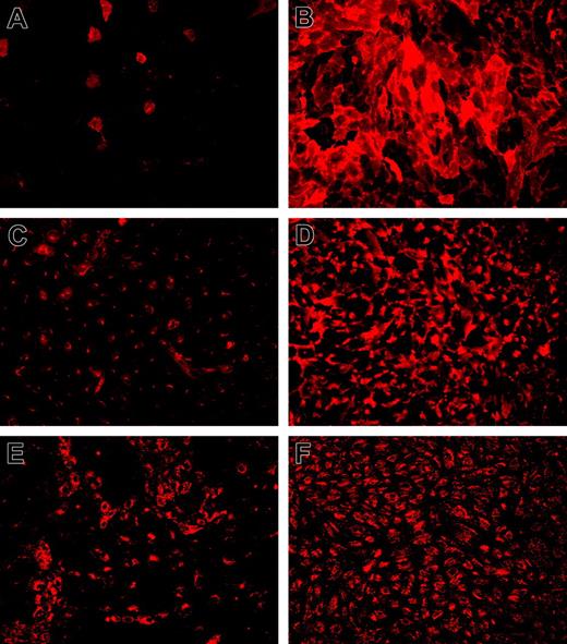 Figure 4. Immunofluorescence analysis of typical endothelial marker genes that are under transcriptional control of KLF2. Immunofluorescence for TM (A-B), eNOS (C-D), and VWF (E-F) was performed on HUVEC cultures 7 days after transduction with mock (A,C,E) and KLF2 (B,D,F) lentivirus. Detergent permeabilization was omitted for TM staining, establishing a fully surface-exposed antibody-accessible localization. Expression of induced eNOS is predominantly located at the plasma membrane near intercellular junctions as also observed in sheared cultures compared with more Golgi-localized protein in mock-transduced cells. Images were acquired using a 10 ×/0.3 NA objective.