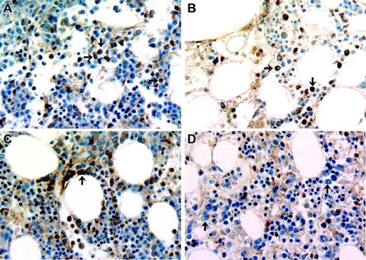 Figure 2. Immunohistochemical detection of cox-2 expression in primary MM cells. Bone marrow samples from 4 patients stained for cox-2 expression. (A-C) Marrow biopsies from 3 patients with myeloma that contains mutated N-RAS or K-RAS. (D) Marrow biopsy from a patient with monoclonal gammopathy of undetermined significance (MGUS). A few plasma cells in each biopsy are depicted with black arrows. Original magnification for all panels, × 40.