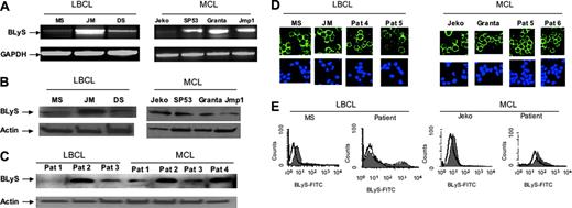 Figure 1. BLyS is constitutively expressed in aggressive NHL-B cells. (A) RT-PCR analysis of BLYS mRNA expression in NHL-B cell lines. (B) Immunoblot analysis of BLyS protein expression in NHL-B cell lines. (C) Immunoblot analysis of BLyS protein expression in cells from representative NHL-B patient biopsies. (D) Confocal immunofluorescence microscopic analysis of BLyS protein localization in LBCL and MCL cell lines and representative biopsy-derived LBCL and MCL patient samples. BLyS protein was stained for Cy2 (green) fluorescence, and the nuclear marker for TOPRO-3 (blue) fluorescence. (E) Flow cytometric analysis of BLyS protein on NHL-B cell surfaces. NHL (LBCL and MCL) cell lines and tumor cells from patient biopsies were stained with FITC-conjugated BLyS antibody (gray histograms) or FITC-conjugated isotype control (open histograms).