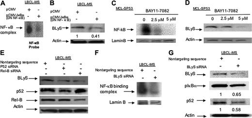 Figure 4. Constitutive BLyS expression through the NF-κB pathway activates a positive feedback loop contributing to NHL-B cell survival. (A) EMSA analysis of NF-κB protein binding to the BLYS promoter. Nuclear extracts from NHL-B cells were transfected with dominant-negative (DN) NF-κB or control plasmid and analyzed with an oligonucleotide probe for the BLYS–NF-κB binding site. (B) Immunoblot analysis of BLyS expression in NHL-B (LBCL-MS) cells transfected with DN NF-κB or control plasmid. Actin was used as loading control. BLyS levels were normalized to those of actin as previously described and presented as relative fold decrease compared to control samples. (C) EMSA analysis of NF-κB protein binding to the BLYS promoter in NHL-B (MCL-SP53) cells treated with various doses of the IκB inhibitor BAY11-7082. Lamin B was used as nuclear protein loading control. (D) Immunoblot analysis of BLyS in NHL-B (MCL-SP53) cells treated with various doses of IκB inhibitor BAY11-7082. (E) Immunoblot analysis for BLyS, p52, and Rel-B expression in NHL-B (LBCL-MS) cells treated with 100 nM p52 or Rel-B siRNA. Actin was used as loading control. (F) EMSA analysis of NF-κB binding to the BLYS promoter. Nuclear extracts from an NHL-B cell line (LBCL-MS) were transfected with BLYS or control siRNA and analyzed with an oligonucleotide probe for the BLYS–NF-κB binding site. Lamin B was used as nuclear protein loading control. (G) Immunoblot analysis of phosphorylated IκBα (pIκBα) and p52 in NHL-B cells transfected with BLYS or control siRNA. pIκBα and p52 protein expression levels were normalized to those of actin as previously described in panel B.