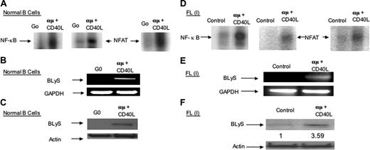 Figure 6. Induction of cellular NF-κB and NFAT activation leads to BLyS protein expression in normal B lymphocytes and low-grade follicular lymphoma (FL) cells. (A) EMSA analysis of normal G0 and activated peripheral blood B cells using the NF-κB or NFAT binding site oligonucleotides from the BLYS promoter. (B) RT-PCR analysis of BLyS expression in normal peripheral blood B cells. (C) Western blot analysis of BLyS in normal peripheral blood B cells. (D) EMSA analysis of tumor cells from a patient with follicular lymphoma (> 90% small cleaved cells: grade 1 FL) using oligonucleotide probes from BLYS-NF-κBor BLYS-NFAT binding sites on the BLYS promoter. (E) RT-PCR analysis of BLyS expression in the FL cells (described in panel D). (F) Western blot analysis of BLyS expression in follicular lymphoma (small cleaved cell lymphoma, grade 1) patient biopsy cells. Actin was used as loading control. BLyS protein expression levels were analyzed by BioMax 1D software as before.
