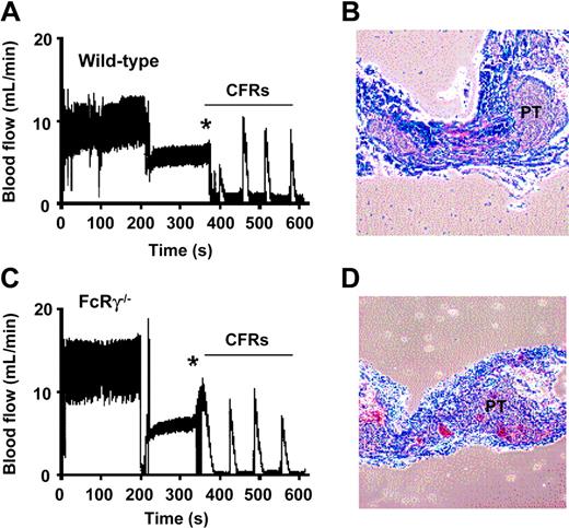 Figure 1. Effect of FcRγ deficiency on occlusive thrombus formation in a “Folts-type” arterial thrombosis model. (A,C) Repetitive crush injury to stenosed carotid arteries was used to induce occlusive thrombus formation in wild-type and FcRγ–/– mice as described in “Materials and methods.” Vascular injury (indicated by *) led to the formation of repetitive cyclic flow reductions (CFRs) in both the wild-type and FcRγ–/– mice. The blood flow traces are from single-mouse experiments representative of 9 and 8 independent wild-type and FcRγ–/– experiments, respectively. (B,D) Histologic analysis of longitudinally sectioned carotid arteries from wild-type mice and FcRγ–/– mice demonstrating the presence of vaso-occlusive platelet-rich thrombi (PT) in the arterial lumen following the development of CFRs.