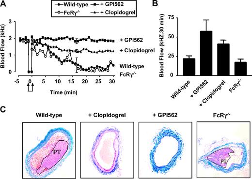 Figure 2. Effect of FcRγ deficiency and integrin αIIbβ3 and P2Y12 inhibition on occlusive arterial thrombus formation following electrolytic injury. (A) Electrolytic injury was induced in the carotid artery of FcRγ-deficient mice (FcRγ–/–, n = 5) or wild-type mice treated with vehicle alone (wild-type, n = 5), GPI562 (5 mg/kg) (+ GPI562, n = 5) or clopidogrel (50 mg/kg) (+ clopidogrel, n = 4) as described in “Materials and methods.” Carotid artery blood flow was monitored over a 30-minute time period following arterial injury (indicated by arrows). Error bars are average SEM from repeated measures ANOVA. (B) Total blood flow over a 30-minute period. Error bars are ± 1 SEM. (C) Histologic analysis of carotid arteries from FcRγ–/– or wild-type mice treated with vehicle alone, GPI562, or clopidogrel. Tissue samples were stained with Castair stain in which platelets stain purple, fibrin stain red, red blood cells stain yellow, and collagen stains blue. Platelet-rich thrombi (PT) are highlighted in wild-type control and FcRγ–/– mice.