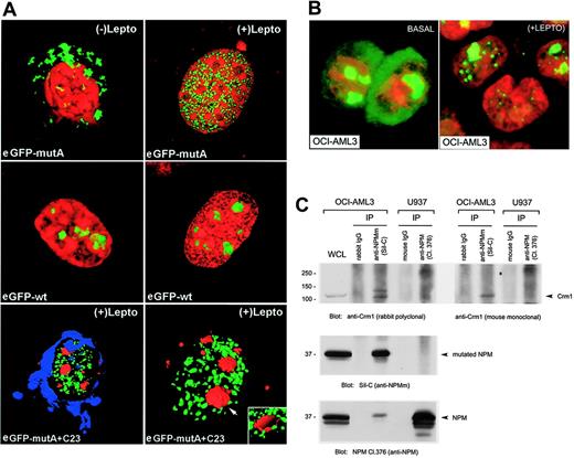 Figure 2. LMB relocates NPM mutants in the nucleoplasm. (A) Confocal microscopy of NIH-3T3 cells transfected with pEGFP-C1-NPMmA or pEGFP-C1-NPMwt in presence and absence of LMB. In basal conditions, the mutant A is cytoplasmic (top left) but relocates in the nucleoplasm (top right) following incubation with LMB. eGFP-NPMwt localizes in the nucleoli both in the presence and absence of LMB (middle panel, left and right). The bottom panel shows LMB-treated cells transfected with pEGFP-C1-NPMmA (green) and immunostained with an antinucleolin (C23) monoclonal antibody (Texas red)–labeling nucleoli (arrow). The nuclear membrane is blue (TO-PRO-3 staining). After LMB, the eGFP-NPM mutant A was relocated in the nucleoplasm. Nucleolar exclusion was confirmed by an electronic cut of the nucleolar surface (inset in the bottom right figure). (B) The anti-NPM antibody 376 labels both nucleoli and cytoplasm of OCI/AML3 cells in the absence of LMB (left). Incubation with LMB results in nucleoplasmic relocation of the cytoplasmic NPM (right). Images were collected as described27 using a Zeiss Plan Apochromat 100 ×/1.4 NA oil objective. (C) OCI-AML3 and U937 cell lysates were subjected to immunoprecipitation (IP) with either control IgG or rabbit anti-NPMm (Sil-C) and mouse anti-NPM (Cl. 376): Western blots with anti-Crm1 antibodies are shown in the top panels. Blotting with the anti-NPMm (Sil-C) and anti-NPM (Cl. 376) antibody are also shown (middle and bottom panels). WCL indicates OCI-AML3 whole-cell lysate included as control.