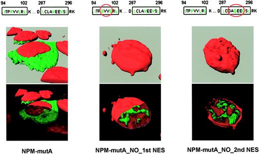 Figure 3. Export of NPM mutants require 2 NES motifs. Confocal microscope analysis of NIH-3T3 transfected with either pEGFP-C1-NPMmA (left panel), pEGFP-C1-NPM_MUT_A_NO_1st_NES (middle panel), or pEGFP-C1-NPM_MUT_A_NO_2nd_NES (right panel). NPM mutant A containing both NES motifs localizes in the cytoplasm. Disruption of either N-terminal (middle panel) or C-terminal (right panel) NES motif in the NPM mutant A impedes nuclear export of the protein that appears localized in the nucleoplasm (middle and right panels, bottom). Images were collected as described27 using a Zeiss Plan Apochromat 100 ×/1.4 NA oil objective.