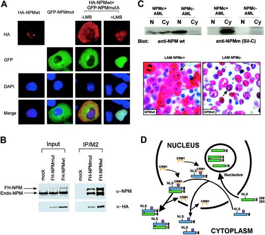 Figure 6. NPM mutant A acts as a dominant-negative on wild-type NPM. (A) Cotransfection of H1299 cells with pEGFP-C1-NPMmA and HA-NPM wild-type. About 30% of cells were transfected and in about 70% of transfected cells the NPM mutant causes partial recruitment of the wild-type NPM from nucleoli to the nucleoplasm and the cytoplasm. (B) Both FH-NPMwt and FH-NPM mutant A interact with the endogenous NPM in H1299 cells. FH-NPM wt and FH-NPM mutant A plasmids were stably transfected into H1299 cells. In the left panel, 5% of the whole-cell lysates from stably transfected FH-NPMwt, FH-NPM mutant A, or control H1299 cells were subjected to Western blot with either α-NPM or α-HA. In the right panel, the rest 95% of whole cell lysates were immunoprecipitated with α-flag (M2), followed by Western blot with either α-NPM or α-HA. (C) Endogenous wild-type NPM protein is dislocated in the cytoplasm of NPMc+ AML primary samples. In the top panel, nuclear and cytoplasmic extracts from either NPMc+ or NPMc– AML primary patient cells were subjected to Western blot analysis with either the anti-NPM mouse monoclonal antibody (clone FC-61991) from Invitrogen (anti-NPM wt) or the Sil-C antibody (anti-NPMm). A strong signal for NPMwt was evident in both the nuclear and cytoplasmic fraction of AML cells carrying NPM mutation but only in the nuclear fraction of NPMc–AML cells. The lower panel shows immunohistochemical study of 2 different AML samples with the anti-NPMwt antibody. The NPMc+ AML sample expresses the wild-type NPM both in the nucleus and cytoplasm (arrow). In contrast, the NPMc–AML sample shows the expected nucleus-restricted expression of wild-type NPM (arrow). Images were collected using an Olympus BX61 microscope and a UPlanFl 100 ×/1.3 NA objective. (D) Hypothetical mechanism of altered nucleo-cytoplasmic traffic of NPM mutant A and wild-type NPM. Red circles indicate tryptophan residues; black circles, mutated tryptophans; magenta boxes, NES motif; blue boxes, mutated NPM protein; and green boxes, wild-type NPM protein. To simplify, the scheme shows only the binding of Crm1 to the mutant NES but not to the physiologic one, nor to the full ternary complex (Crm1-NES-ranGTP). NLS indicates nuclear localization signal.
