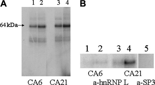 Figure 4. Identification of hnRNP L as the major protein in nuclear extracts of B16F10 cells that binds CA6 or CA21 mRNA probes. (A) A 32P-labeled mRNA probe representing either the FVB/NJ sequence (CA6) (lane 1, 1 μg; lane 2, 5 μg) or the BALB/cJ sequence (CA21) (lane 3, 1 μg; lane 4, 5 μg) was mixed with a nuclear extract from B16F10 cells and subjected to UV irradiation. The mRNA-protein complexes were then separated by SDS-PAGE, and proteins that had bound each probe were visualized by autoradiography. The major complex has a MWApp of 64 kDa, the mobility expected for hnRNP L. On the basis of optical scanning and densitometry, the intensity of the analogous band obtained with the FVB/NJ CA6 probe is approximately 50% of that obtained with the BALB/cJ CA21 probe. (B) Immunoprecipitation of mRNA-protein complexes with anti-hnRNP L. A 32P-labeled CA6 mRNA probe (lane 1, 1 μg; lane 2, 5 μg) or CA21 mRNA probe (lane 3, 1 μg; lane 4, 5 μg) was mixed with a nuclear extract from B16F10 cells and subjected to UV irradiation. mRNA-protein complexes were then precipitated with anti-hnRNP L. The immunoprecipitate were isolated and washed, and the components of the precipitate were solubilized in SDS and separated by SDS-PAGE. Proteins that had bound probe were visualized by autoradiography. Once again a single major band with a MWApp of 64 kDa is clearly visible in lane 4. As a negative control, the procedure was repeated with anti-Sp3 (lane 5). In this case, no labeled protein bands were detected in the immunoprecipitate. The results depicted were derived from 1 experiment that is representative of 3 independent experiments.
