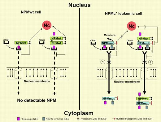 Hypothetical mechanism of altered nucleocytoplasmic traffic of wild-type and mutant NPM. (Left) NPM wild-type (wt) cells show nucleus-restricted NPM positivity. Nuclear export of NPM wild-type (NPMwt) is minimum since it contains only one NES motif available for binding to CRM1 (Exportin 1). Tryptophans 288 and 290 drive NPMwt to nucleolus (Nc), thus acting as a counterforce to NES-dependent NPMwt nuclear export. As a consequence, no NPMwt is detectable in the cytoplasm by immunohistochemistry. (Right) In cells carrying NPM exon 12 mutations, NPM mutants accumulate in the cytoplasm (NPMc+), since they contain 2 NES motifs (1 created at C-terminus by the mutation) available for CRM1 binding. Moreover, they carry mutated tryptophans 288 and 290, which inhibit binding of NPM leukemic mutants to nucleolus (Nc), facilitating their nuclear export. A portion of NPmwt (which escapes NPM mutant recruitment) can bind to nucleoli (not shown). The circled 1 indicates where leptomycin B blocks nuclear export of NPM leukemic mutants by specific inhibition of CRM1. Red squares represent physiologic NES motif; gray squares, new C-terminus NES motif; black ovals, tryptophans 288 and 290; and orange ovals, mutated tryptophans 288 and 290.