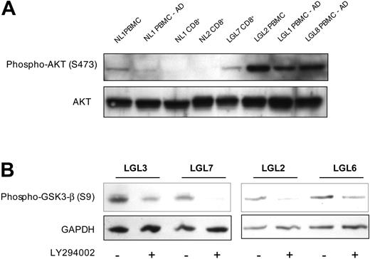 Figure 1. PI3K-AKT pathway activity in T-LGL cells. (A) Lysates of purified CD8 T cells or PBMCs before and after adherent cell depletion, as indicated, from healthy donors and patients with T-LGL were prepared by direct addition of 2 × SDS sample buffer after a brief 15-minute incubation at 37°C and separated on a 10% SDS-PAGE gel. Following transfer to nitrocellulose membrane, samples were sequentially analyzed for phosphorylated AKT (S473) and total AKT protein via immunoblotting. Cell equivalents (3 × 105) were loaded in all lanes. (B) PBMCs from 4 patients with T-LGL were incubated at 37°C for 15 minutes in the presence or absence of LY294002 (50 μM), followed by immediate addition of 2 × SDS sample buffer. Proteins were separated on an SDS-PAGE gel as in panel A, transferred to nitrocellulose, and immunoblotted for phosphorylated GSK-3β (S9). GAPDH levels were probed to indicate consistency of protein loading.