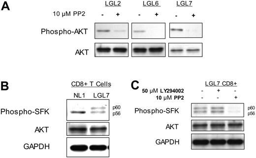 Figure 2. PI3K activity in T-LGL is dependent on the activation of a Src family kinase. (A) PBMCs from 3 patients with T-LGL were incubated at 37°C for 15 minutes in the presence or absence of the SFK inhibitor PP2 (10 μM), followed by immediate addition of 2 × SDS sample buffer. Cell equivalents (3 × 105)/lane were run on a 10% SDS-PAGE gel, transferred to nitrocellulose, and immunoblotted for phosphorylated AKT (S473) and total AKT. (B) CD8+ T cells isolated from a healthy donor and a patient with T-LGL via RosetteSep were resuspended in RPMI at 5 × 107 cells/mL and incubated at 37°C for 15 minutes, followed by immediate addition of 2 × SDS sample buffer and immunoblotted with an antibody specific for active SFKs. (C) CD8+ T cells isolated from a patient with T-LGL via RosetteSep were resuspended in RPMI at 5 × 107 cells/mL and incubated at 37°C for 15 minutes in the presence or absence of LY294002 (50 μM) or PP2 (10 μM), as indicated. Lysates prepared as for panel B were immunoblotted for phospho-SFK. Total AKT and GAPDH protein levels are shown as loading controls.