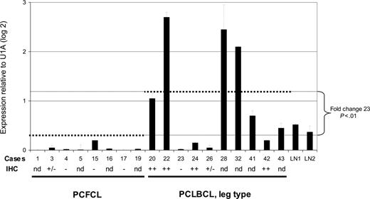 Figure 1. Expression of AID mRNA in PCFCL and PCLBCL, leg type. Expression of AID mRNA was measured in triplicate using quantitative real-time PCR and normalized to the expression of the housekeeping gene small nuclear ribonucleoprotein particle U1A (U1A). Error bars indicate standard deviations. Case numbers correspond to cases presented in Tables 1-2. dotted lines indicate the average AID mRNA expression within the group of PCFCL and PCLBCL, leg type; – indicates no tumor cells stained; +/– indicates less than 10% of tumor cells stained; and ++ indicates more than 50% of tumor cells stained. LN indicates lymph nodes; IHC, immunohistochemical staining; and nd, not determined.