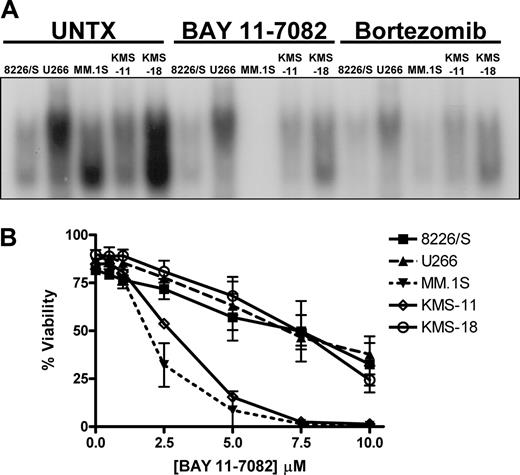 Figure 2. Multiple myeloma cell lines respond differently to direct inhibition of NF-κB than they do to direct inhibition of the 26S proteasome. (A) Whole-cell lysates were prepared from untreated multiple myeloma cell lines, cells treated with 5 μM BAY 11-7082 or cells treated with 100 nM (8226/S and U266 cells), 25 nM (KMS-11, KMS-18), or 5 nM (MM.1S) bortezomib and incubated with a double-stranded NF-κB oligonucleotide probe. Samples were run on a native polyacrylamide gel, and NF-κB binding was visualized by autoradiography. (B) Five different human multiple myeloma cell lines were cultured for 24 hours in increasing concentrations of the NF-κB inhibitor BAY 11-7082. Cell viability, as assessed by Annexin V–FITC and propidium iodide staining, is presented as the mean ± SD from at least 3 independent experiments.