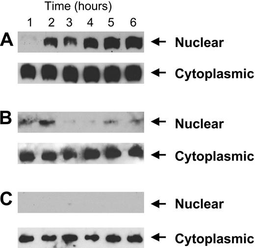 Figure 7. Nuclear translocation of thioredoxin following exposure of proliferating endothelial cells to HKa. (A) Cells were cultured in 10 cm2 fibronectin-coated plates at a concentration of 3 × 104 cells/mL and stimulated with 10 ng/mL bFGF and 50 nM HKa. At increasing intervals, cell extracts were prepared and separated using 15% SDS-PAGE, as described in “Materials and methods.” After transfer to PVDF, membranes were incubated with peroxidase-conjugated goat anti–mouse thioredoxin antibodies and developed using enhanced chemiluminescence. No thioredoxin translocation occurred in cells exposed to bFGF alone in the absence of HKa (not shown). (B) Experiments were conducted as described in panel A but HKa-exposed cells were incubated concurrently with 150 μg/mL GSH. No nuclear translocation of thioredoxin occurred under these conditions. (C) Experiments were performed as described in panel A but using cells cultured on type I collagen.