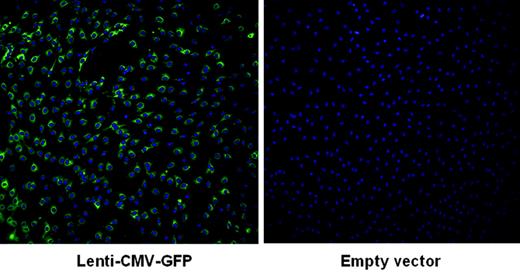 Figure 4. Fluorescent microscopy analysis of the transduction efficiency of canine VWD BOECs. Canine VWD BOECs were subjected to a centrifugal transduction (900g, 30 minutes, 32°C at an MOI of 20) with Lenti-CMV-GFP (left) or empty vector (right), and 7 days after transduction, the presence of GFP was analyzed by using a fluorescence microscope. Cell nuclei were stained with DAPI.