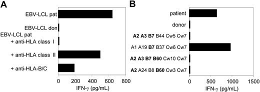 Figure 2. CTL clone RDR173 recognizes an mHag presented in HLA-B7. (A) EBV-LCL cells preincubated with antibodies against HLA class I, HLA class II, or HLA B and C alleles were tested for recognition by CTL clone RDR173. (B) EBV-LCL cells expressing one or more HLA class I alleles in common with the patient (A2, A3, B7, B60, Cw3) were incubated with CTL clone RDR173 for 24 hours. Release of IFN-γ was determined by using ELISA. HLA alleles that are shared with the patient are depicted in bold.