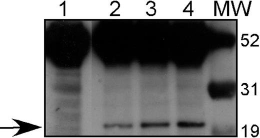 Figure 4. Expression of HA-tagged A1 in stable transfectants. 32D cl3 cells were transfected with pcDNA3-HA-Bfl1 as described, and G418-resistant clones were isolated. Western blotting with an antibody against the HA tag was performed on total cellular protein from 3 of these transfectants: 32DA1.1 (Lane 2), 32DA1.2 (Lane 3), and 32D A1.3 (Lane 4), as well as protein from untransfected 32D cl3 cells (Lane 1). The arrow indicates the presence of HA-tagged A1 in the transfected cells but not in the parental cells. Molecular-weight markers are shown in the lane marked MW.