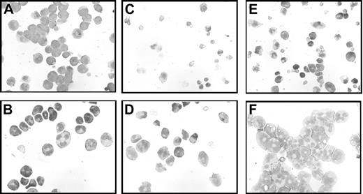 Figure 6. Morphology of 32DA1 cells in different growth conditions. 32DV4 (A,C,E) and 32DA1.3 cells (B,D,F) were grown in IL-3 (A-B), without cytokine (C-D), or in G-CSF (E-F). Photomicrographs of cells attached to glass slides using a Cytospin apparatus and then stained with Wright/Giemsa stain are shown.