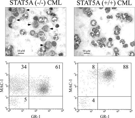 Figure 4. Increased myeloid immaturity in STAT5A–/– CML. Photomicrographs and FACS plots of representative mice with the CML-like illness induced by P210/STAT5A–/– or P210/STAT5A+/+ BM cells. Note the increased proportion of morphologically immature myeloid cells (arrows) in P210/STAT5A–/– CML, associated with an increase in MAC1+ cells that lack expression of the mature granulocytic marker GR1. Cell percentage is depicted in the top right portions of each grid. Similar results were seen in 3 additional mice from each cohort (average values in “CML-related survival is prolonged in P210/STAT5A–/–-reconstituted mice.”