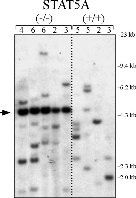 Figure 5. The absence of STAT5A in hematopoietic progenitors does not reduce CML clonality. Genomic DNA was prepared from P210/STAT5A–/– and P210/STAT5A+/+ leukemia cells isolated from mice with the CML-like disease, digested with the restriction enzyme Bgl II, and analyzed by Southern blot to assess the clonality of proviral integration. The number of unique leukemic clones is shown at the top for each CML animal. Size markers are shown at far right. Note that the neomycin resistance gene probe also detects the neomycin resistance cassette present in the STAT5A targeting vector (arrow).