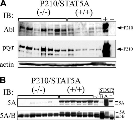 Figure 6. Bcr/Abl protein expression is constitutively increased in P210/STAT5A–/– CML. (A) Leukemia cells from P210/STAT5A–/– or P210/STAT5A+/+ mice with CML or CML/ALL were analyzed by anti-Abl or antiphosphotyrosine immunoblot. Ba/F3 cells expressing P210 (+) or not (–) are shown at far right as controls. Actin serves as a loading control (bottom panel). (B) Leukemia cells were analyzed by western immunoblot using an antibody specific for STAT5A (5A), or an antibody recognizing both STAT5A/B. Controls for STAT5A/5B and their migration positions are shown at far right. Note that the STAT5A-specific antibody (top panel) cross-reacts slightly with the slower migrating form of STAT5B.