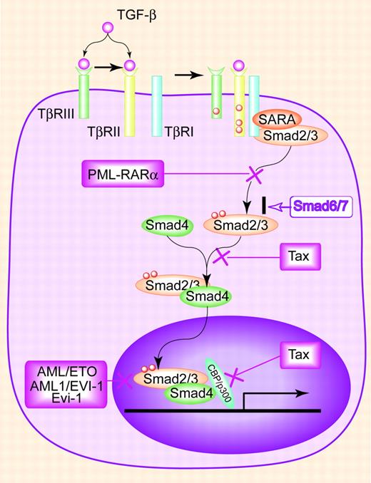 Figure 1. The TGF-β signaling pathway and mechanisms of inhibition during leukemogenesis. TGF-β binds TβRII, directly or through TβRIII, inducing association of TβRII with TβRI. TβRII then phosphorylates and activates TβRI, which then phosphorylates Smad2 or Smad3. SARA acts to concentrate Smad2/3 near the cell surface, facilitating their phosphorylation by TβRI. Phosphorylated Smad2/3 associate with Smad4 and translocate into the nucleus, where they activate transcription of target genes. Smad7 inhibits TGF-β signaling by preventing TβRI's activation of Smad2/3. In leukemias, disease-specific oncoproteins disrupt this pathway through different mechanisms. PML-RARα prevents the phosphorylation of Smad2/3 by interrupting the formation of TGF-β receptor/SARA/Smad complexes. AML/ETO, AML/EVI-1, and Evi-1 inhibit Smad3 DNA binding and recruit the transcription repressor, CtBP. Tax disrupts the interaction of Smads with the transcriptional coactivator CBP/p300 and blocks the formation of Smad2/3/4 complexes.