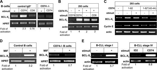 Figure 7. Stimulation of CD74 by anti-CD74 or MIF in normal and malignant cells induces BCL-XL expression. (A-B) BCL-XL expression. IgD+ B cells from control mice or B cells from CD74–/– mice were stimulated with anti-CD74 antibody or nonspecific anti-CD8 antibody for 24 hours. Total RNA was isolated, and reverse transcription was carried out using Superscript II RT. The results presented are representative of 5 separate experiments (A). 293 cells transfected with the FL CD74 construct. Five hours following transfection the cells were stimulated or not with anti-CD74 or nonspecific antibodies (anti-CD8) for 12 hours (B). RT-PCR was performed as described in “Materials and methods.” (C) 293 cells transfected with the CD74 1-82 or 1-82 mutated in its 42 to 44 aa (1-82*42-44) constructs. Five hours following transfection the cells were stimulated or not with anti-CD74 for 12 hours. Reverse transcriptase–polymerase chain reaction (RT-PCR) was performed as described in “Materials and methods.” (D) B cells from control or CD74–/– mice were stimulated in the presence or absence of MIF for 10 hours as described in “Materials and methods.” Total RNA was isolated, and reverse transcription was carried out using Superscript II RT. The results presented are representative of 3 separate experiments. (E) Stage I and stage IV B-CLL B cells were stimulated in the presence or absence of anti-CD74 antibody or nonspecific anti-ID2 antibody for 18 hours. Total RNA was isolated, and reverse transcription was carried out using Superscript II RT. The results presented are representative of 6 separate experiments. The intensity of the BCL-XL band following each treatment was divided by the intensity of the HPRT band in each treatment. The activation-fold ratio in the absence of any treatment was normalized to 1, and the ratio for each treatment was calculated as the intensity of the treatment sample relative to 1.