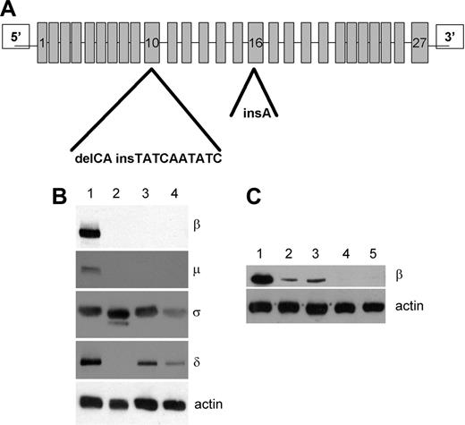 Figure 1. Composite heterozygous ADTB3A mutation in 2 novel HPS2 patients. (A) Mutational analysis of ADTB3A in 2 patients (Pt 1 and Pt 2) and their parents showed 2 novel mutations. The mother and both the children (Pt 1, Pt 2) present a deletion/insertion in exon 10 at position 1063-1064 of the coding region. C and A are substituted by a 10-base sequence: TATCAATATC. The frame shift in the coding sequence (from the Q at 355 position) leads to a stop codon at position 360 (Q355fsX360). The father and the 2 patients carry a single A insertion at position 1789-1790 in the exon 16, leading to a frame shift (from I at 597 position) and to a stop codon at amino acidic residue 608 (I597fsX608). (B) Cell lysates from both HPS2 Pt 1 and Pt 2 (lanes 3 and 4), a previously identified HPS2 patient1 (lane 2), and a control subject (lane 1) were separated by SDS-PAGE and probed for the AP-3 subunits (see “Patients, materials, and methods”). Lysates contained 2 × 107 cells per milliliter. β-actin was used to compare protein levels. (C) Western blot probed with anti-β3A using lysates from control (lane 1), the previously identified HPS2 patient1 using lysates with 4 × 107 (lane 2) and 8 × 107 (lane 3) cells per milliliter, and 4 × 107 from HPS2 patients Pt 1 (lane 4) and Pt 2 (lane 5). β-actin was used to compare protein levels.