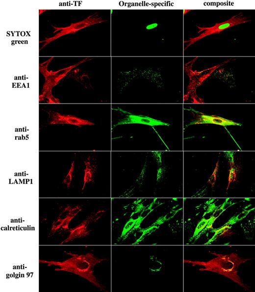 Figure 2. Intracellular distribution of tissue factor in fibroblasts. Fibroblasts were fixed, permeabilized, and stained with anti–human TF and an organelle-specific antibody. Left column represents TF staining; middle column, organelle-specific staining; and the right column, the overlay image (colocalization) of TF and organelle-specific marker. Organelle-specific antibodies/stain used as follows: SYTOX Green for nucleus, anti-EEA1 and anti-rab5 for early endosomes, anti-LAMP1 for lysosomes, anticalreticulin for endoplasmic reticulum, and anti–golgin-97 for the Golgi. Note: In contrast to EEA1, whose localization is limited to early endosomes, rab5 is also known to present in the cytoplasmic side of the plasma membrane and clathrin-coated vesicles.