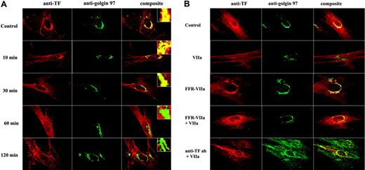 Figure 4. Factor VIIa mobilizes tissue factor from the Golgi. (A) Fibroblasts were exposed to FVIIa (10 nM) for different time intervals (0 to 120 minutes). Cells were fixed, permeabilized, and immunostained with rabbit polyclonal anti–human TF and monoclonal anti–human golgin-97 antibodies, followed by Rhodamine Red–labeled anti–rabbit IgG and Oregon Green–labeled anti–mouse IgG as secondary reporter antibodies. (B) Factor VIIa's protease activity and the binding to cell-surface tissue factor are essential for the trafficking of tissue factor from the Golgi. WI-38 cells were exposed to FVIIa (10 nM) or FFR-FVIIa (10 nM) alone for 2 hours at 37°C or first incubated with 20-fold molar excess of FFR-FVIIa or anti-TF IgG (10 μg/mL) for 30 minutes before FVIIa (10 nM) was added to the cells. The cells were stained with anti-TF and anti–golgin-97 antibodies and analyzed as described in panel A. Left panel images represent TF staining, middle panel images represent the Golgi staining, and right panel images represent the overlay of TF and the Golgi staining (colocalization). Insets in panel A show a magnified view of TF localization in the Golgi.