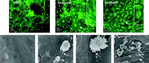 Figure 3. TJ alterations in BMVECs during coculture with activated monocytes. Endothelial cells are positive for VWF(A) and express occludin (B, arrow) at cell-cell contacts. Application of monocytes resulted in occludin relocalization to cytoplasm (C, arrow). Monocyte migration occurs across TJs in the BBB model. (D) Endothelial cells demonstrate a flat surface without gaps in control BBB constructs (without monocytes). Scanning electron microscopy revealed monocyte attachment to endothelial cell contacts (E, arrows) and their migration between endothelial-cell borders (F, arrow). Massive monocyte migration in response to MCP-1 resulted in focal gap formation of the endothelial monolayer (G). Original magnification (A-C) × 200; (insets, B-C) × 400; (D-E) × 4000; (F) × 7000; (G) × 1200. Images were visualized using a 20 ×/0.5 NA (A-C) or a 40 ×/0.75 NA (B-C, insets) objective and were acquired using a Color View II digital CCD camera.
