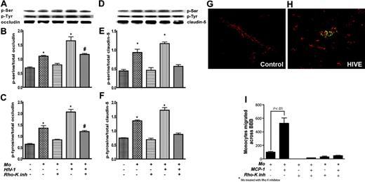 Figure 7. Activation of Rho in BMVECs by monocytes leads to phosphorylation of TJ proteins, and RhoK inhibitor (Y-27632) blocks monocyte migration across the BBB. The content of phosphorylated occludin and total occludin was measured in endothelial cells, endothelial cells cocultured with monocytes, and monocytes cocultured with endothelial cells after pretreatment with the RhoK inhibitor (Y-27632). (A) Representative immunoblots of phosphorylated occludin/claudin-5, total occludin/claudin-5, and internal standard, actin. (B) Ratio of phosphorylated occludin–actin (phosphoserine). (C) Ratio of phosphorylated occludin–actin (phosphotyrosine). (D) Representative immunoblots of phosphorylated claudin-5, total claudin-5, and internal standard, actin. (E) Ratio of phosphorylated claudin-5–actin (phosphoserine). (F) Ratio of phosphorylated claudin-5–actin (phosphotyrosine). Each bar represents mean value ± SEM (n = 4). (G-H) Human brain sections were double immunostained with antibodies to occludin/phosphoserine. While no immunostaining for phosphoserine was found in control brain tissue (G), phosphoserine staining (green) partially overlapped with occludin (red) on brain microvessels in HIVE (H). (G-H) Original magnification, × 400. Images were visualized using a 40 ×/0.75 NA objective and were acquired using a Color View II digital CCD camera. (I) Monocyte migration (105 monocytes applied to BBB constructs) was studied in response to MCP-1 (5 ng/mL in the bottom chamber). Pretreatment of endothelial cells in the top chamber or monocytes (before application to top chamber*) with RhoK inhibitor, Y-27632 (2 hours; 10 μM), diminished monocyte migration across the BBB by 90% and 85%, respectively. Results were normalized to migration of uninfected monocytes without MCP-1 (a value of 100%). Values represent mean of quadruplicate determinations ± SEM.