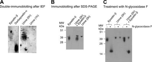 Figure 1. False-positive detection of epoetin-β in urine. (A) Urine samples collected from the athlete immediately after a 4 × 1000 m sprint (0 hours) and 1 hour later (1 hour) contained 1.2 g and 0.3 g proteins/L, respectively. The samples were concentrated 200-fold and 800-fold, respectively, and processed for the detection of Epo by double immunoblotting after isoelectric focusing, as detailed in “Study design.” Also shown are the reference samples darbepoetin-α (1 ng) and epoetin-β (0.6 ng) (B) Immunoblotting of a postexercise urine sample (0 hours, 10-fold concentrated) after SDS-PAGE with anti-Epo antibodies. Also illustrated are epoetin-β (0.9 ng) and a mixture of the urine sample and 0.9 ng epoetin-β. (C) Immunoblotting of the same samples before and after a treatment with N-glycosidase F, as indicated.
