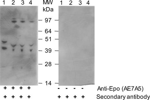 Figure 2. Lack of specificity of the AE7A5 anti-Epo antibodies. Four urine samples (lanes 1-4), obtained from the same athlete on 4 different days immediately after a 4 × 1000 m sprint, were concentrated 20-fold by ultrafiltration and subjected to immunoblotting after SDS-PAGE with monoclonal (clone AE7A5) anti-Epo antibodies (left blot). The right blot was treated identically except for the absence of anti-Epo antibodies. The protein concentration in the nonconcentrated samples amounted to 1.2 (lane 1), 1.1 (lane 2), 0.47 (lane 3), and 0.9 (lane 4) g/L.
