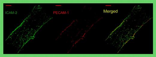 Whole-mount double staining of a representative venule in the mouse cremaster muscle for ICAM-2 (green) and PECAM-1 (red). Note that both proteins are concentrated and superimposed at endothelial cell contacts. Merge shown on the right. See the complete figure in the article beginning on page 4721.