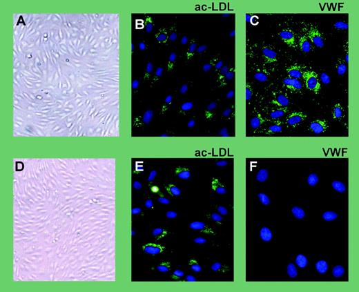 Phenotype of normal and VWD canine BOECs by phase contrast and fluorescence microscopy. See the complete figure in the article beginning on page 4728.